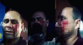 Caminhoneiro leva marretada no rosto durante tentativa de assalto em São Paulo