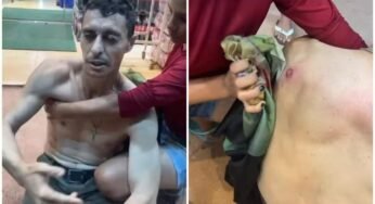 Caminhoneiro é baleado após pedir para condutor reduzir farol em rodovia no oeste do Pará