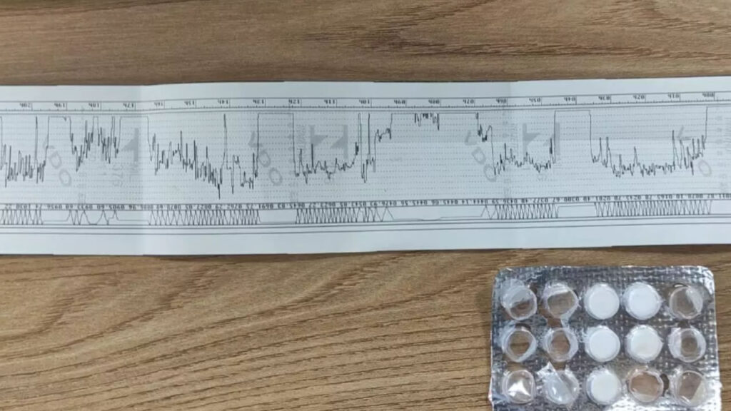 PRF flagra caminhoneiro com “rebite” após dirigir 19 horas seguidas entre MG e MS