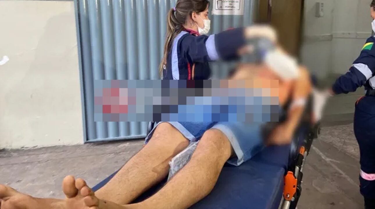 Caminhoneiro sofre emboscada em Rio Branco e é baleado na cabeça em ataque brutal