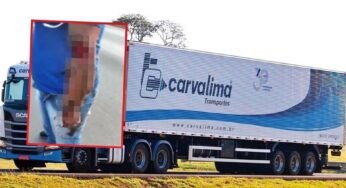 Justiça condena transportadora de Cuiabá a pagar mais de R$ 2 milhões a motorista que perdeu o braço em acidente de trabalho