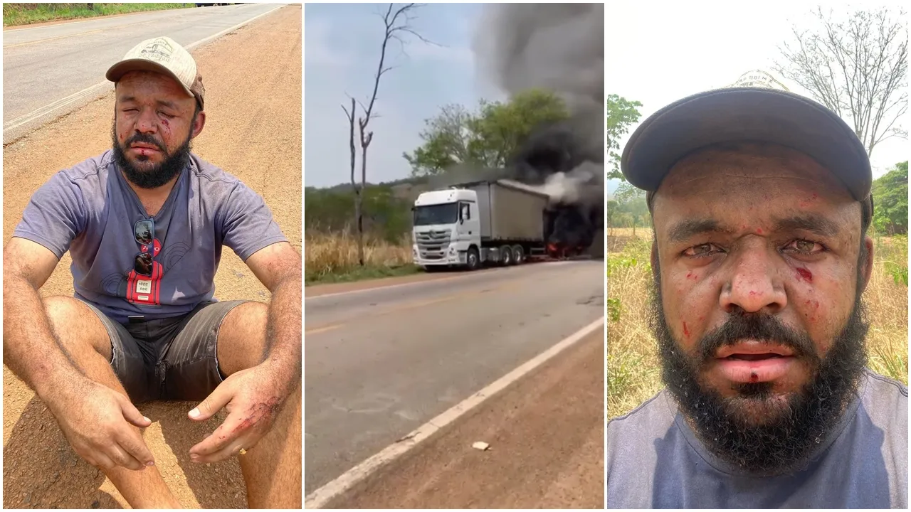 Caminhoneiro Se Acidente Ao Tentar Apagar Fogo