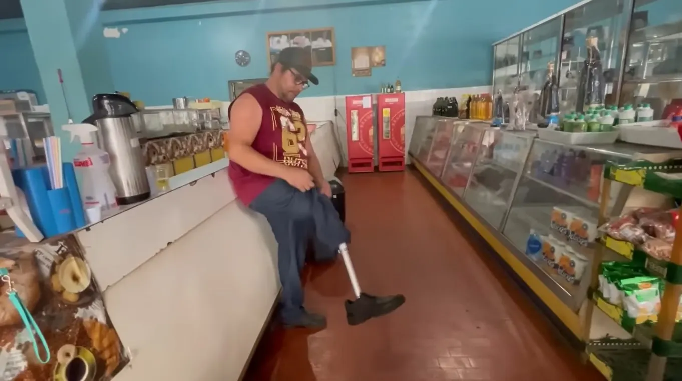 Motorista de caminhão, dirige sem uma perna, esse é um exemplo