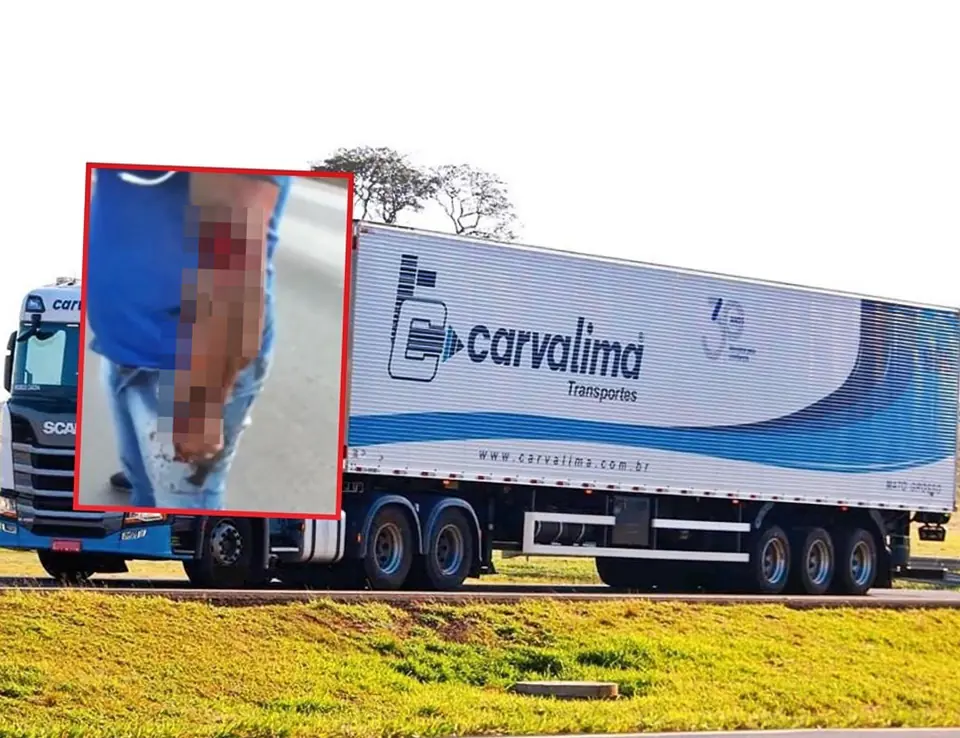 Justiça condena transportadora de Cuiabá a pagar mais de R$ 2 milhões a motorista que perdeu o braço em acidente de trabalho