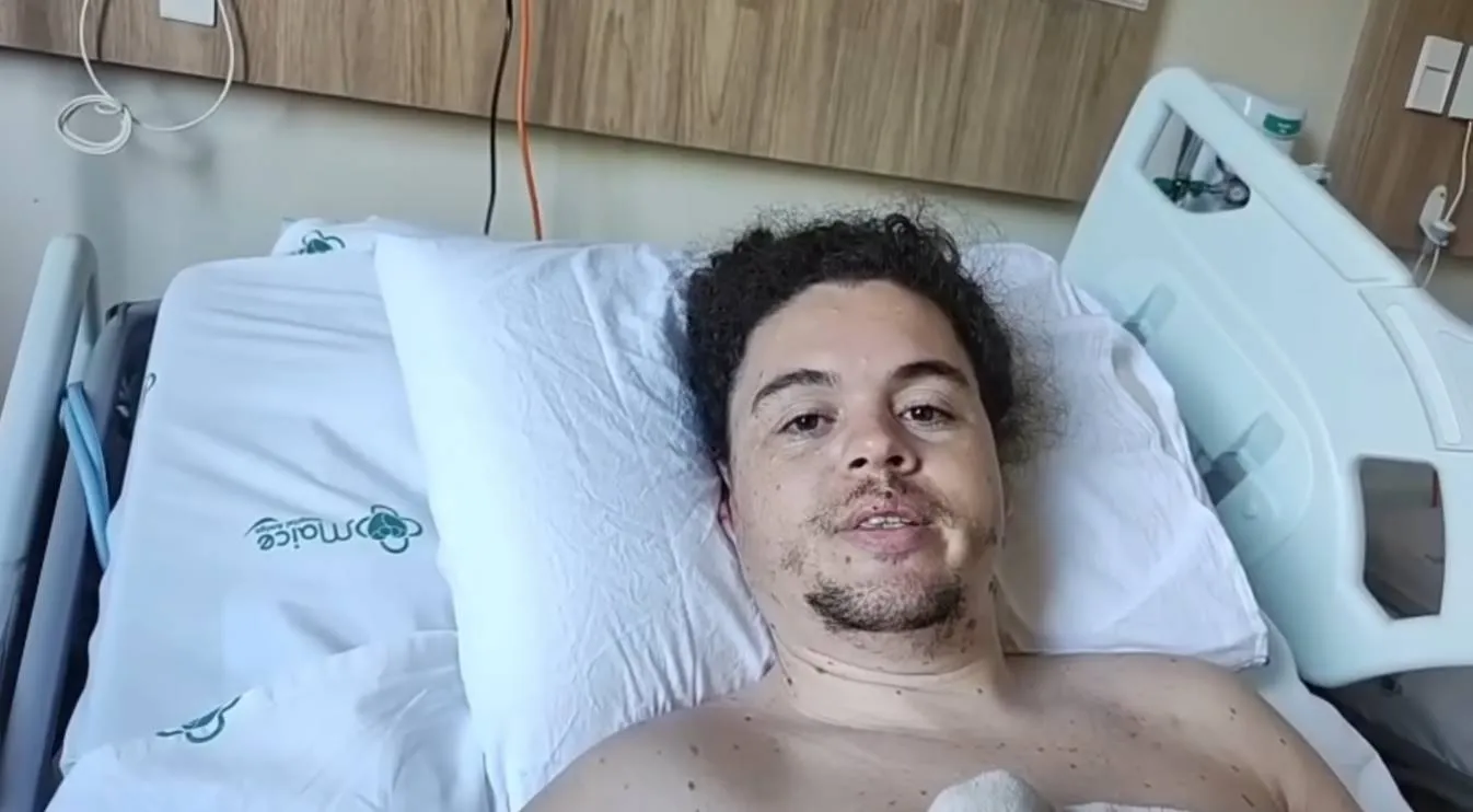 Caminhoneiro “Safadão”, irmão do Cabelo Batateiro, emociona ao falar da dor após grave acidente